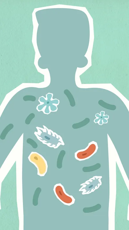 Ulcerative colitis - symptoms and treatment at Clínica Eupnea Palamós