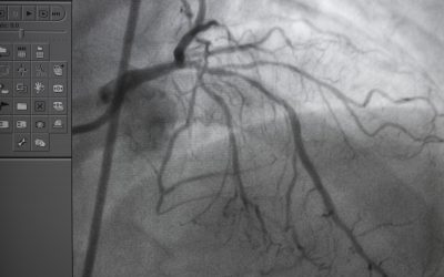 Maladie coronarienne : Le type de maladie cardiaque le plus courant